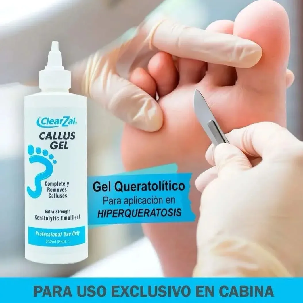 Callus gel