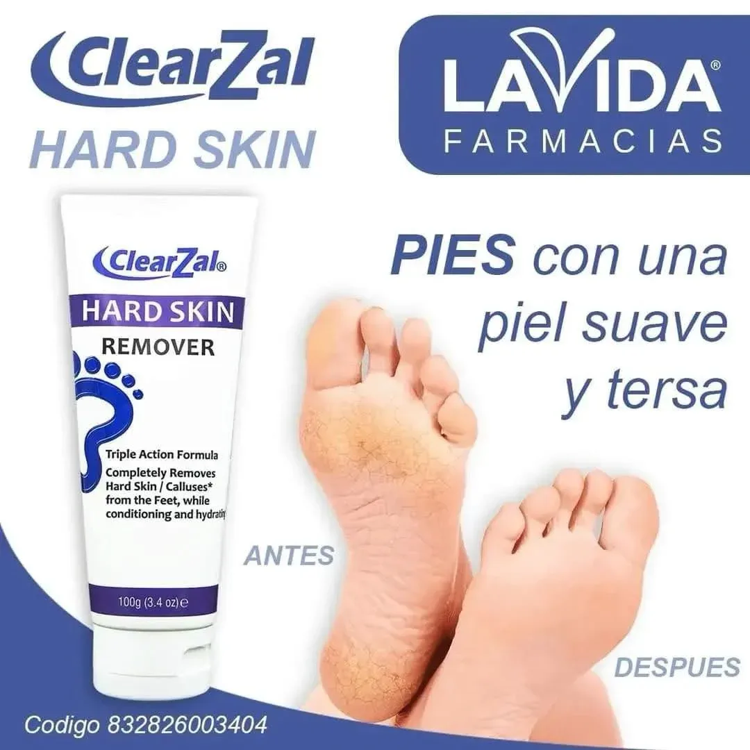 Hard Skin