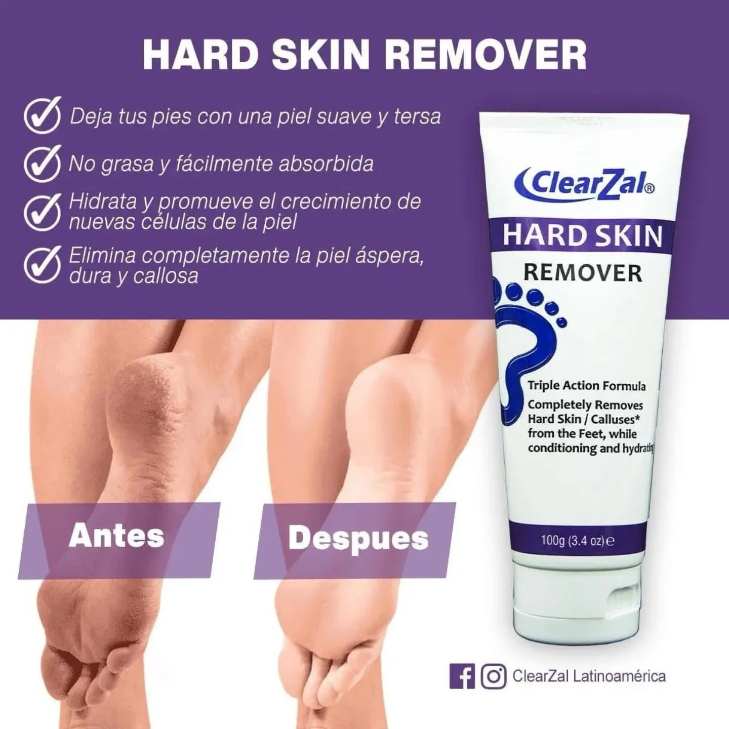 Hard Skin