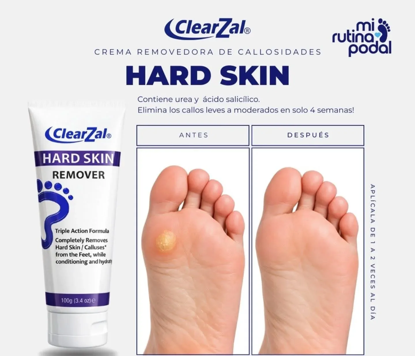 Hard Skin
