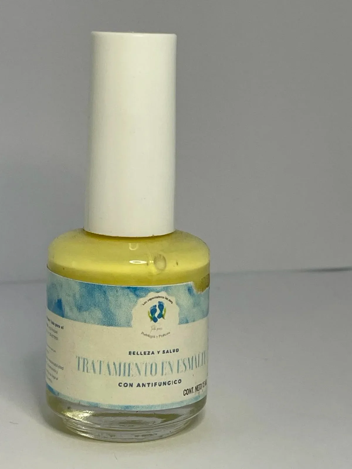 Tratamiento en esmalte #41